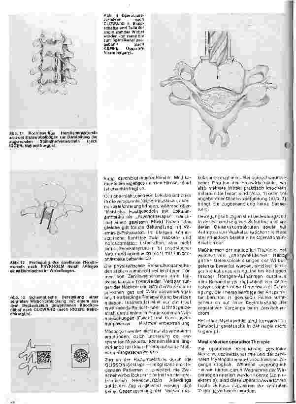 Vorschauseite 5: Themen aus der Neurochirurgie 5. folge: Das Zervikalsyndrom