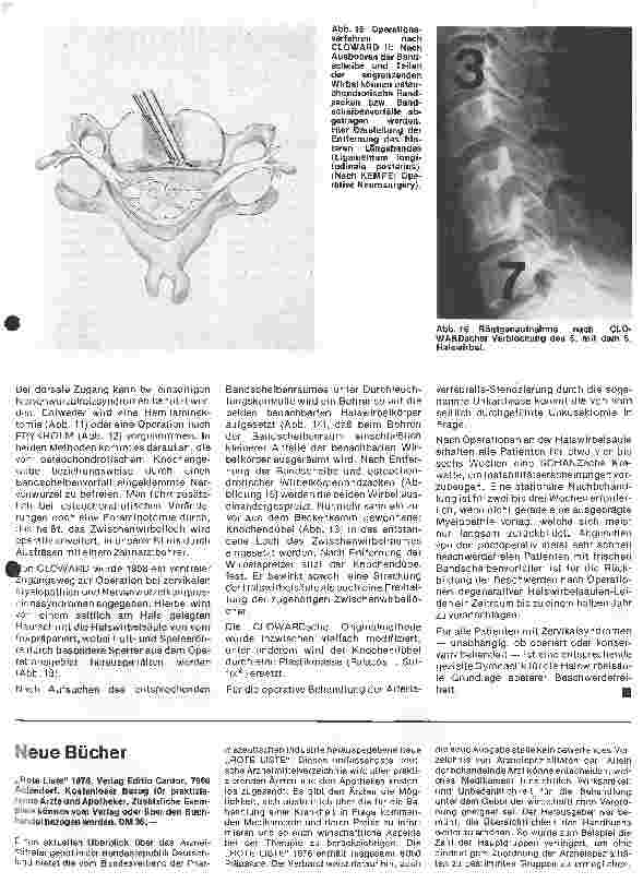 Vorschauseite 6: Themen aus der Neurochirurgie 5. folge: Das Zervikalsyndrom