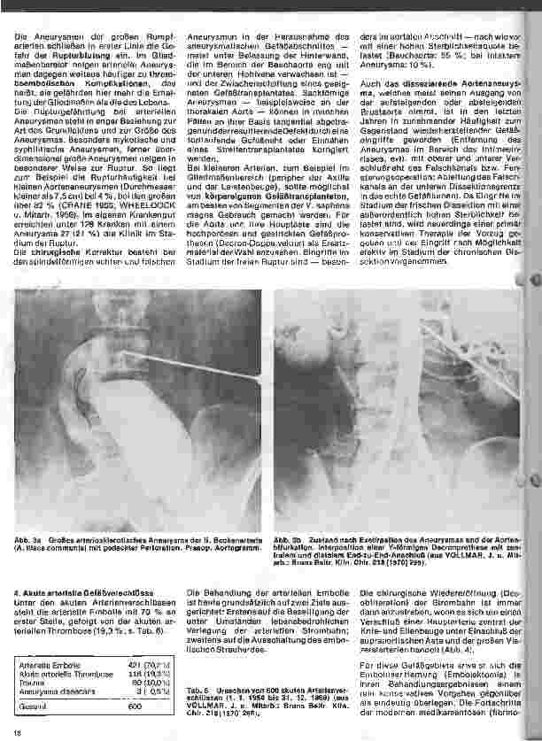 Vorschauseite 3: Aktuelles aus der Gefäßchirurgie 1. Folge: Akute Gefäßnotfälle
