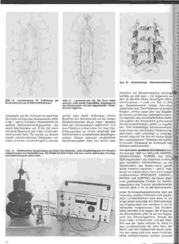 Vorschauseite 5: Themen aus der Neurochirurgie 7. Folge: Operationen am Rückenmark