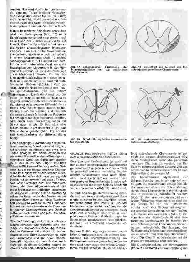 Vorschauseite 6: Themen aus der Neurochirurgie 7. Folge: Operationen am Rückenmark