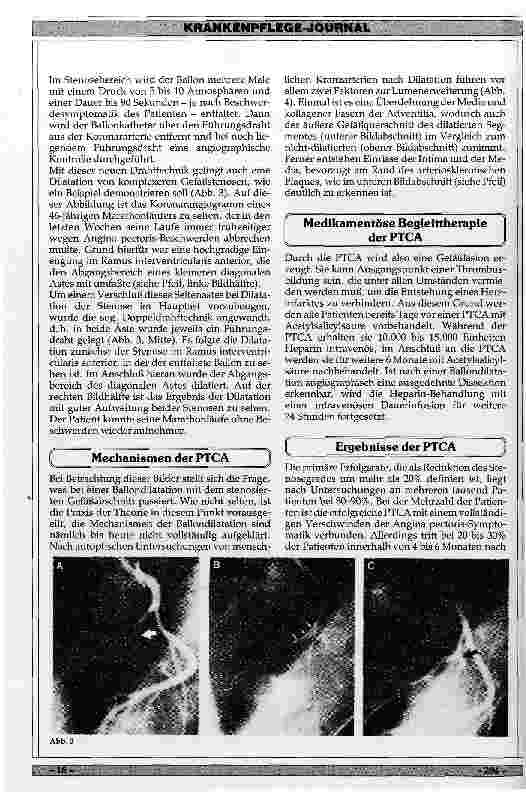 Vorschauseite 2: Möglichkeiten und Ergebnisse der perkutanen transluminalen Koronarangioplastie