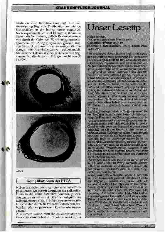 Vorschauseite 3: Möglichkeiten und Ergebnisse der perkutanen transluminalen Koronarangioplastie