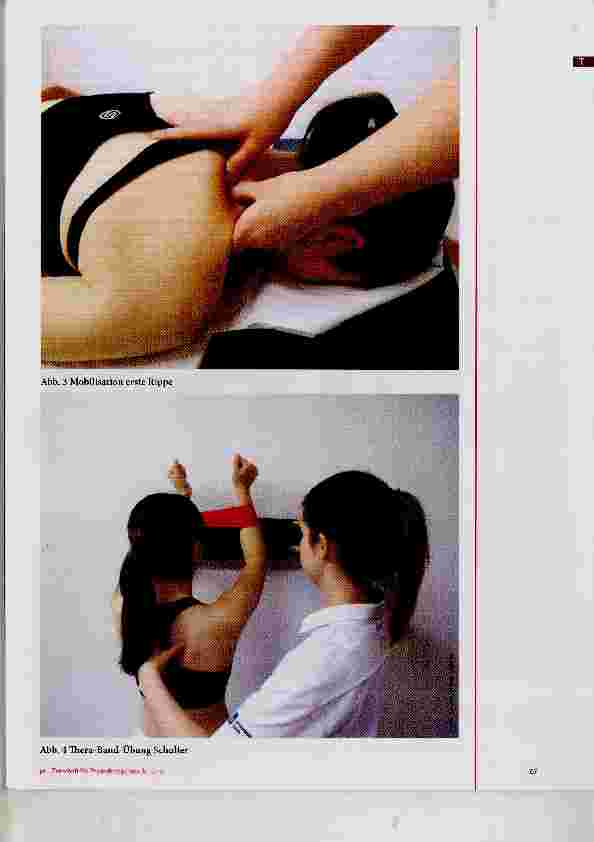 Vorschauseite 6: Neurogenes Thoracic-outlet-Syndrom