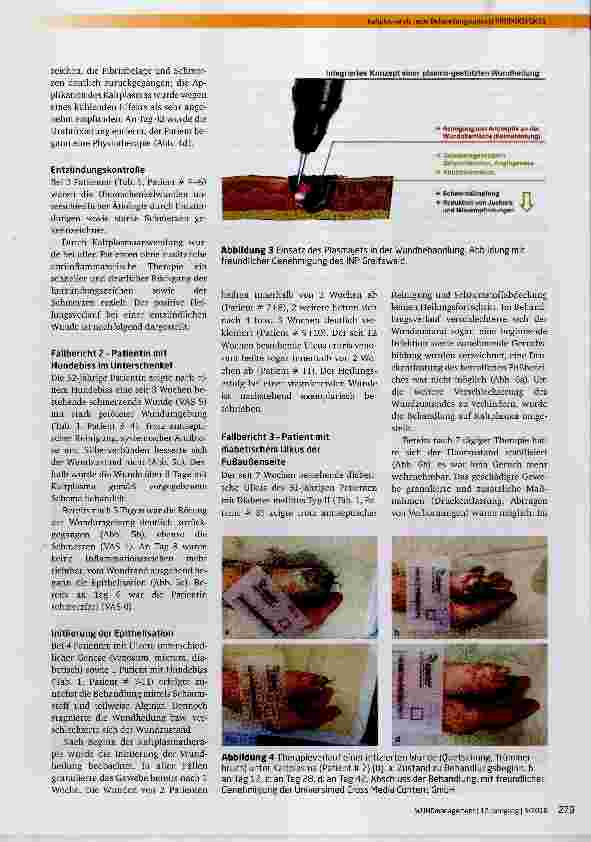 Vorschauseite 5: Kaltplasma als neue Behandlungsoptlonbei häufig auftretenden Wundsituationen im klinischenAlltag: eine Pilot-Fallserie