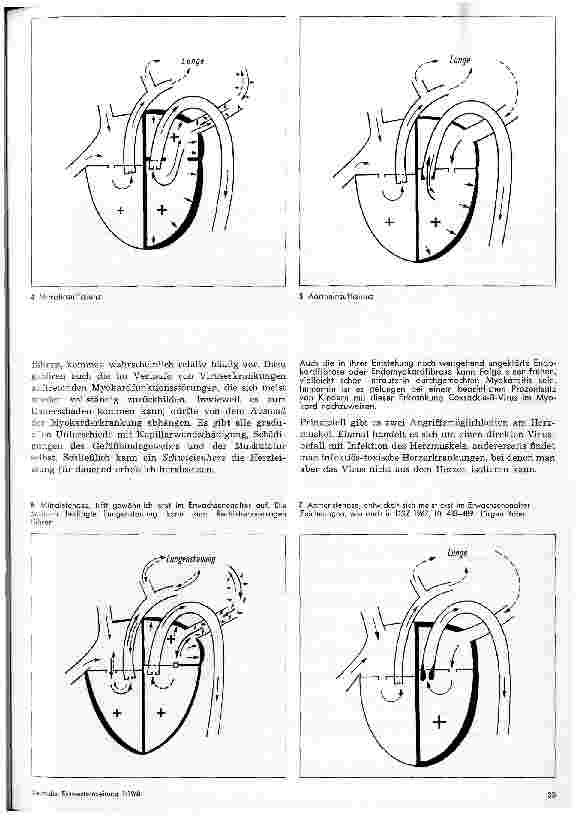 Vorschauseite 3: Erworbene Herzkrankheiten im Kindesalter