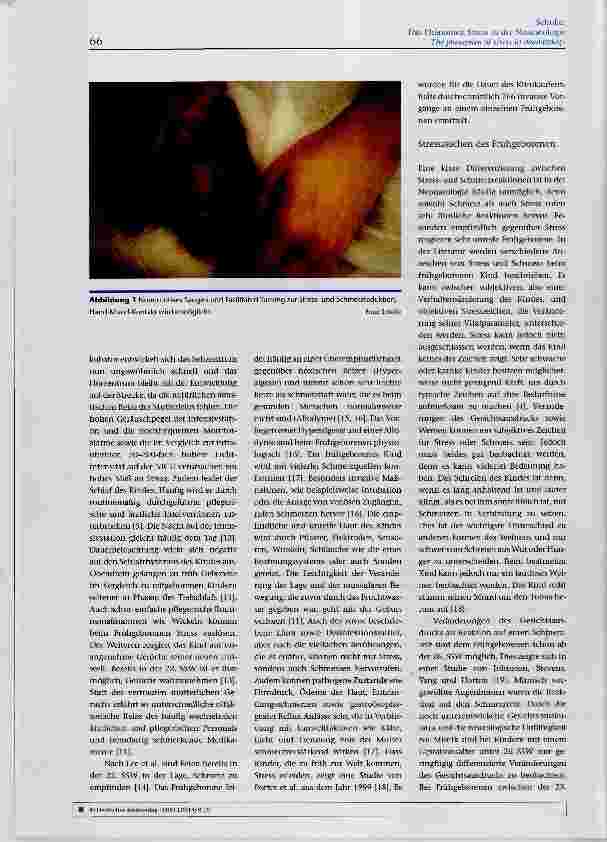 Vorschauseite 3: Das Phänomen Stress in der Neonatologie