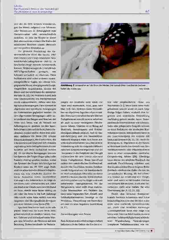Vorschauseite 4: Das Phänomen Stress in der Neonatologie