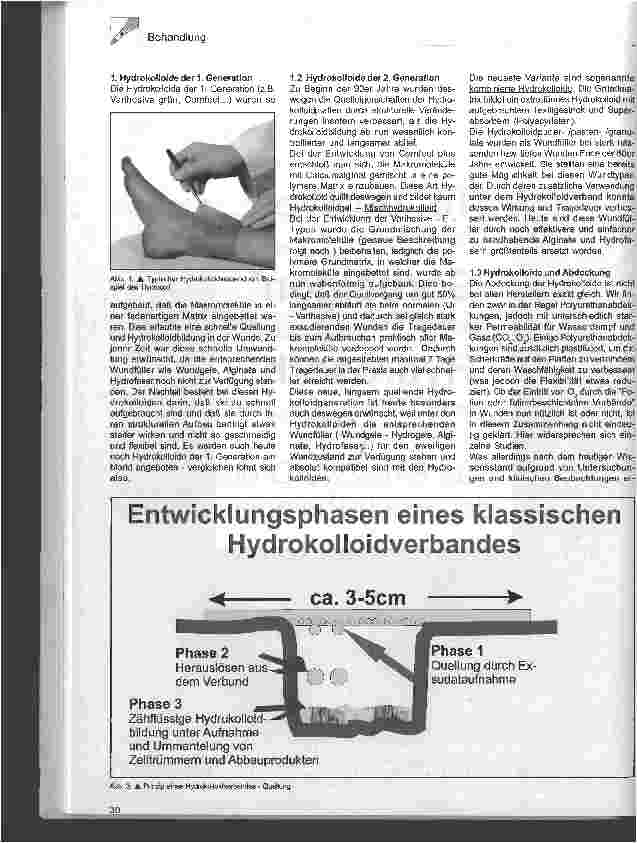 Vorschauseite 2: Moderne Wundauflagen Teil I - Hydrokolloide