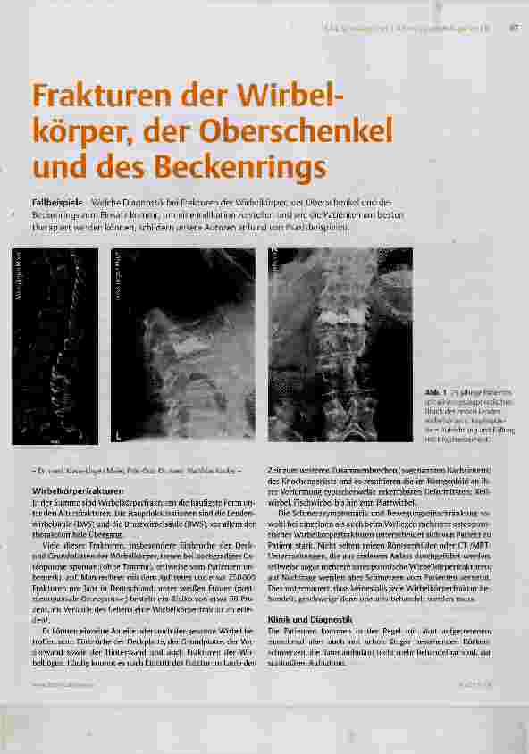 Vorschauseite 1: Frakturen der Wirbelkörper, der Oberschenkel und des Beckenrings