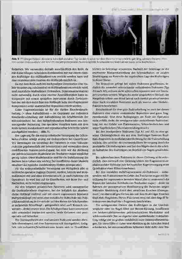Vorschauseite 5: Frakturen der Wirbelkörper, der Oberschenkel und des Beckenrings