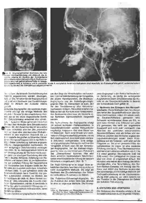 Vorschauseite 5: Themen aus der Neurochirurgie 11 Folge: Todeszeitbestimmung aus neurochirurgischer Sicht