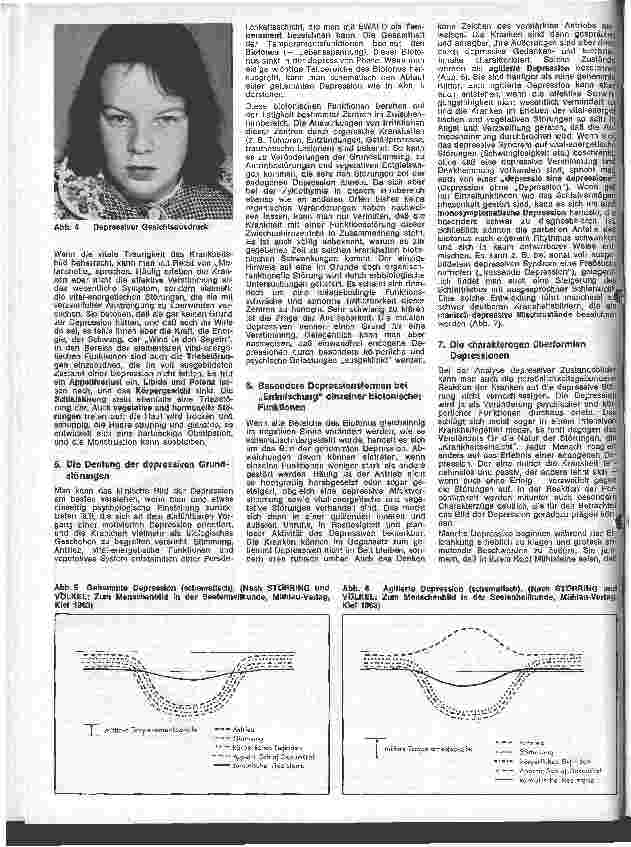 Vorschauseite 3: Die Schwester in der Psychiatrie 3. Folge: Endogene Psychosen A) Manisch-depressive Erkrankungen (Zyklothymie)