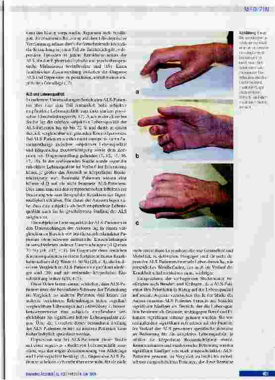 Vorschauseite 5: Depression und Lebensqualität bei Patienten mit amyotropher Lateralsklerose