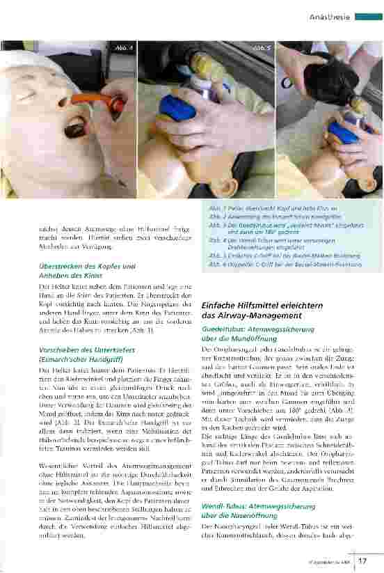 Vorschauseite 2: Airway-Management bei Reanimation Atemwege sicher freihalten
