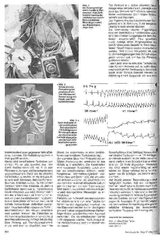 Vorschauseite 2: Implantation eines Defibrillators: Indikation und Technik