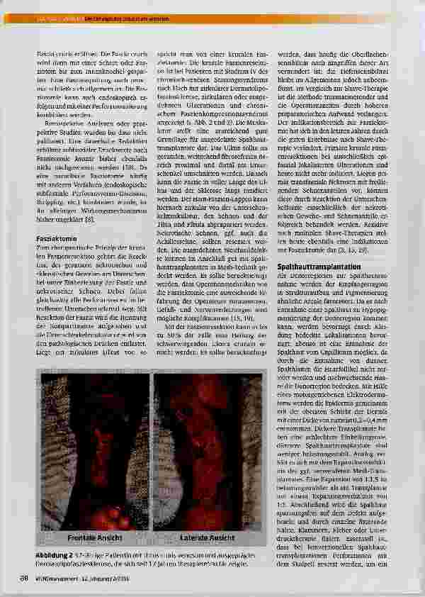 Vorschauseite 4: Die Chirurgie des Ulcus cruris venosum