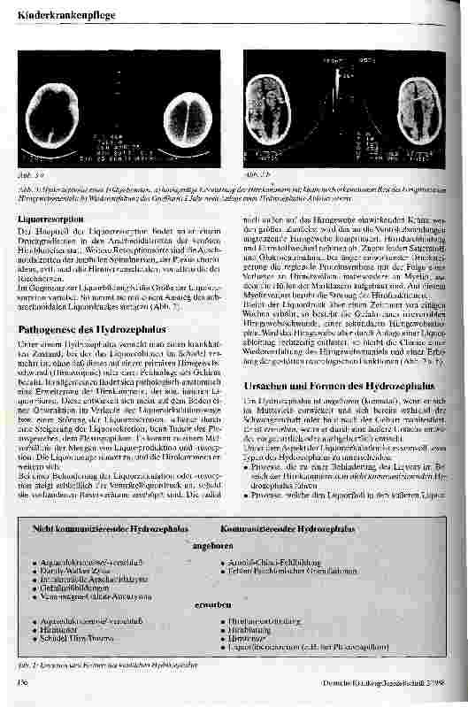 Vorschauseite 2: Der kindliche Hydrozephalus und seine Behandlung
