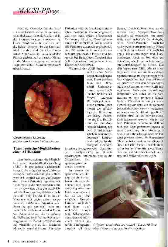 Vorschauseite 2: Die verkannte Chance AHB - Abschlußbehandlung bei Stoma-Patienten