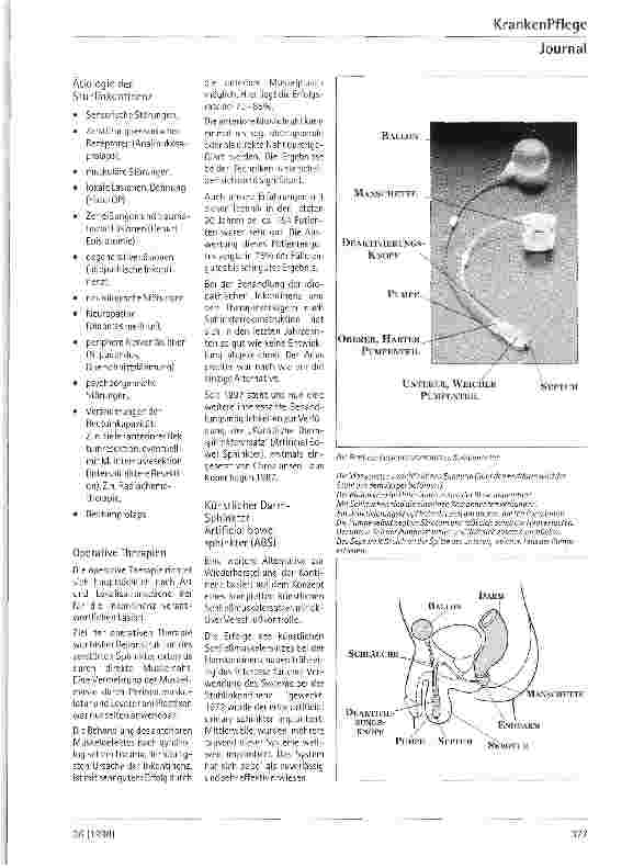 Vorschauseite 2: Stuhlinkontinenz - Neue chirurgische Wege der Behandlung ABS - (Künstlicher Darmschließmuskel)