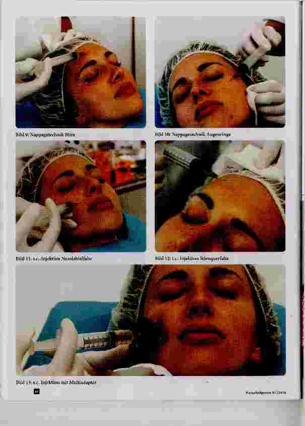 Vorschauseite 4: PRP im ästhetischen Bereich