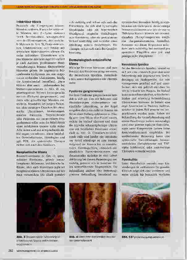Vorschauseite 2: Wunden in der Dermatologie