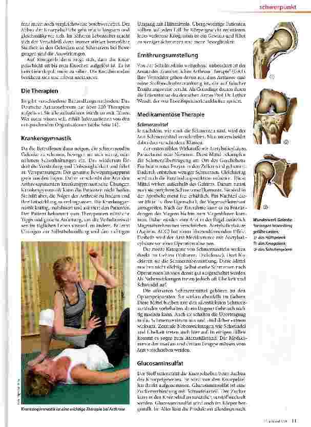 Vorschauseite 2: Arthrose Wenn es in den Gelenken knirscht