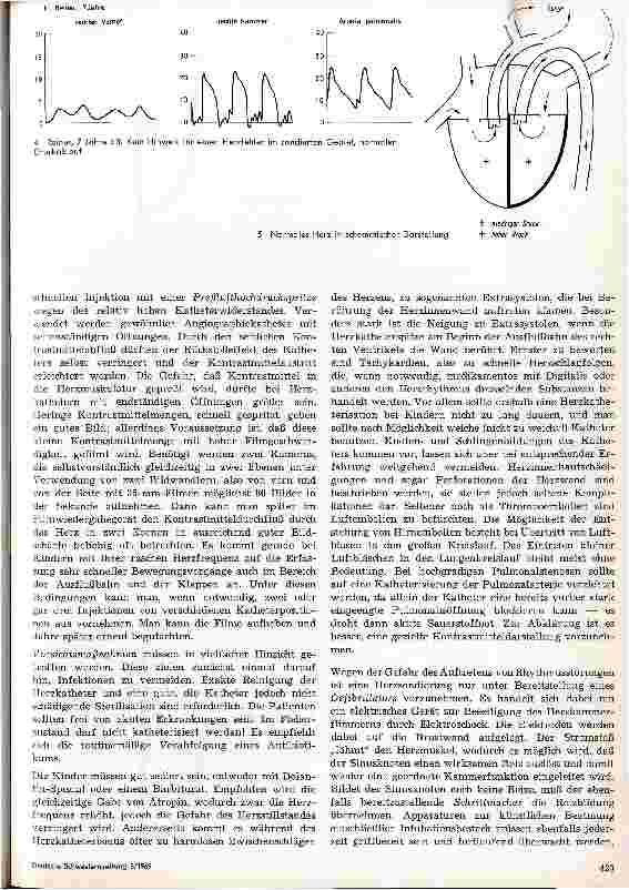 Vorschauseite 5: Herzkatheterismus im Kindesalter