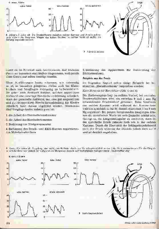 Vorschauseite 6: Herzkatheterismus im Kindesalter