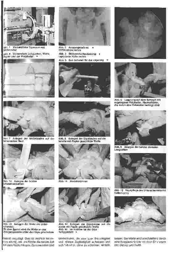 Vorschauseite 2: Angeborene Hüftdysplasie und Hüftluxation 2. Teil: Pflege und Behandlung von Säuglingen mit Schale und Gips