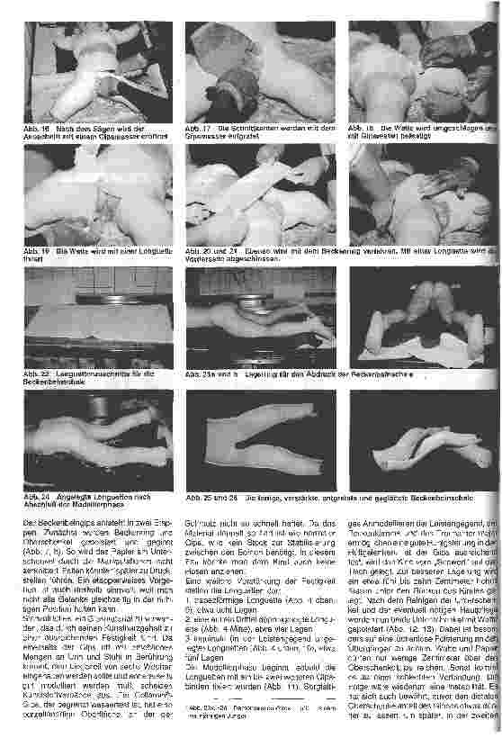 Vorschauseite 3: Angeborene Hüftdysplasie und Hüftluxation 2. Teil: Pflege und Behandlung von Säuglingen mit Schale und Gips