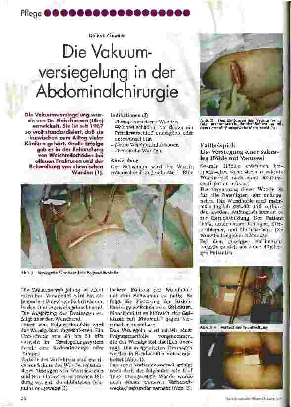 Vorschauseite 1: Die Vakuumversiegelung in der Abdominalchirurgie