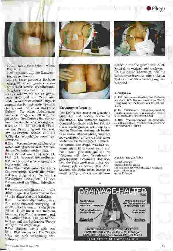 Vorschauseite 2: Die Vakuumversiegelung in der Abdominalchirurgie