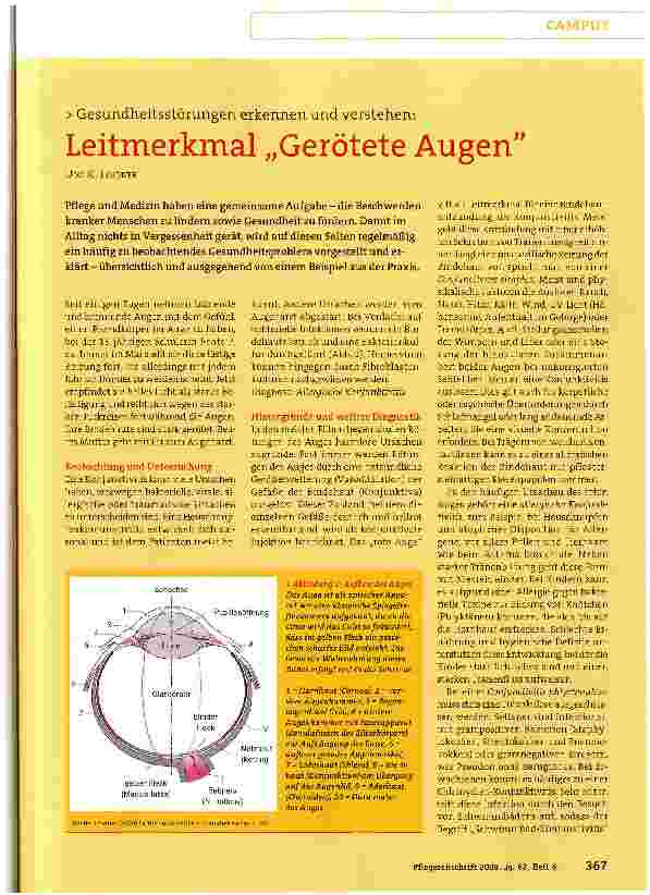 Vorschauseite 1: Leitmerkmal „Gerötete Augen