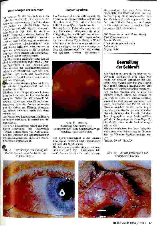 Vorschauseite 3: Augenentzündungen und rheumatische Krankheiten