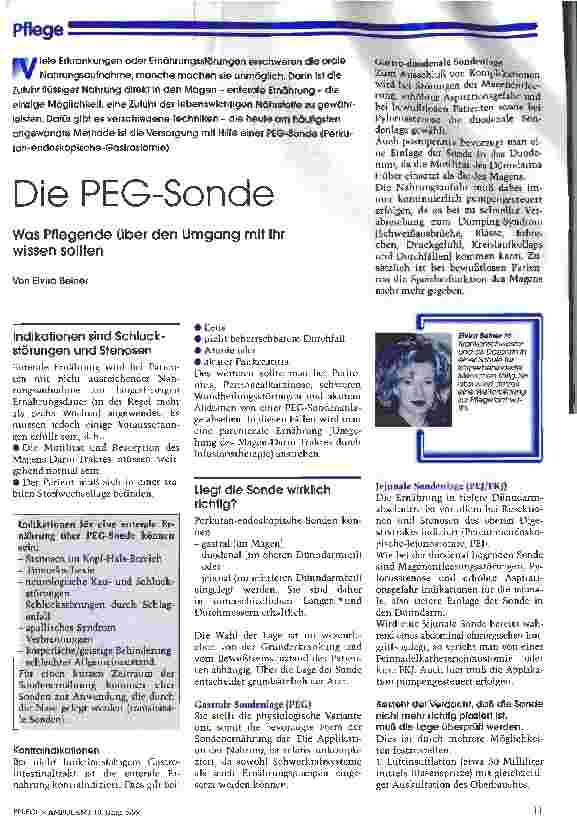 Vorschauseite 1: Die PEG-Sonde
