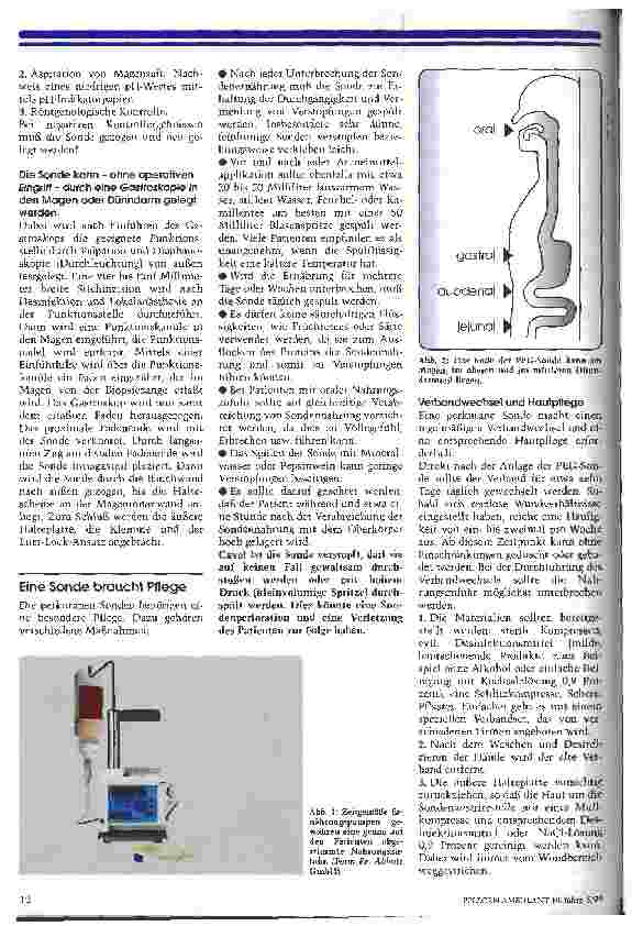 Vorschauseite 2: Die PEG-Sonde