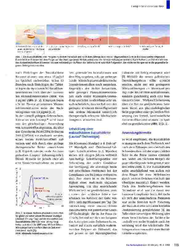 Vorschauseite 2: Therapie der oralen Candidose