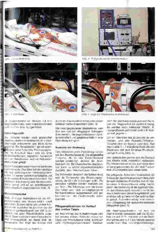 Vorschauseite 2: Pflegealltag in der pädiatrisch-neonatologischen Intensivpflege - dargestellt am Pflegeablauf eines asphyktischen Zwillings -