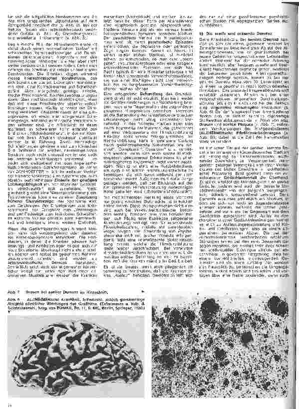 Vorschauseite 3: Die Schwester in der Psychiatrie 14. Folge: Psychiatrische Alterserkrankungen