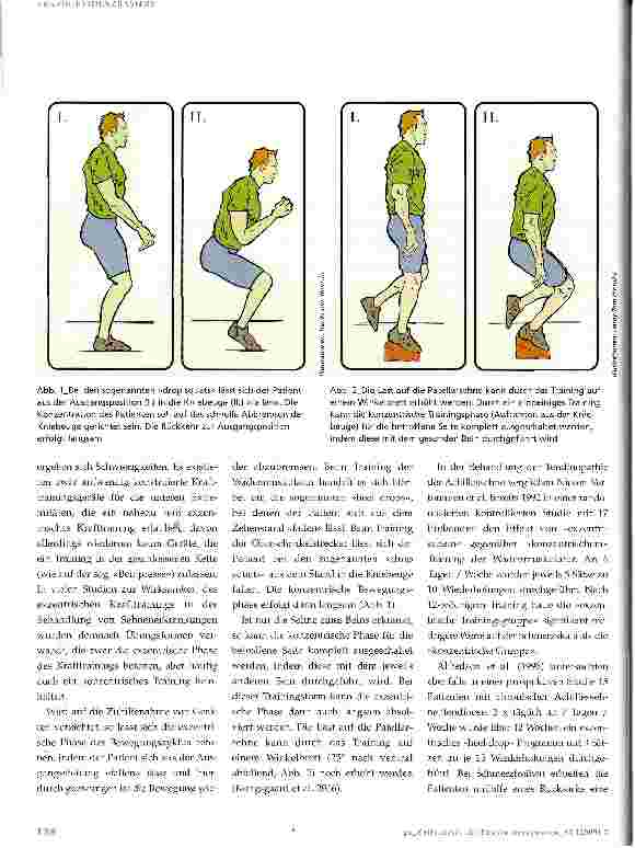 Vorschauseite 4: Die Tendinopathie der Patellarsehne Konservative Therapiemöglichkeiten - Teil 2