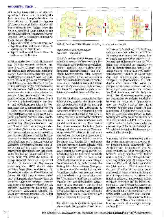 Vorschauseite 3: Indikationen und Methoden der konservativen Behandlung von Wirbelfrakturen