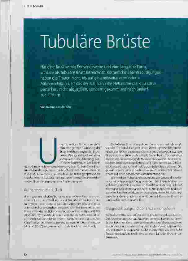 Vorschauseite 1: Tubuläre Brüste