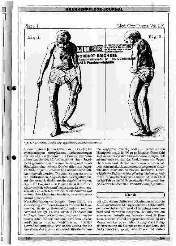 Vorschauseite 2: Ursachen, Klinik und Therapie des M. Paget des Skelettes