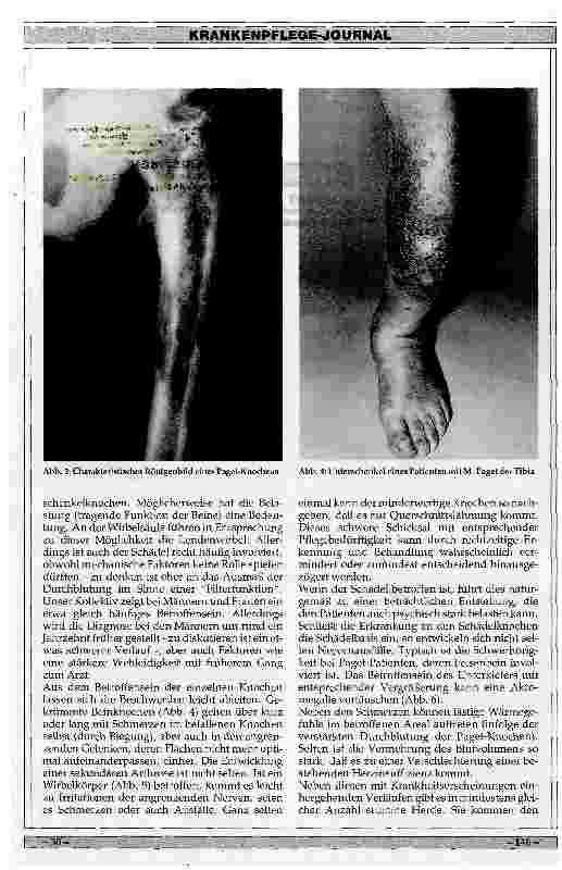 Vorschauseite 3: Ursachen, Klinik und Therapie des M. Paget des Skelettes