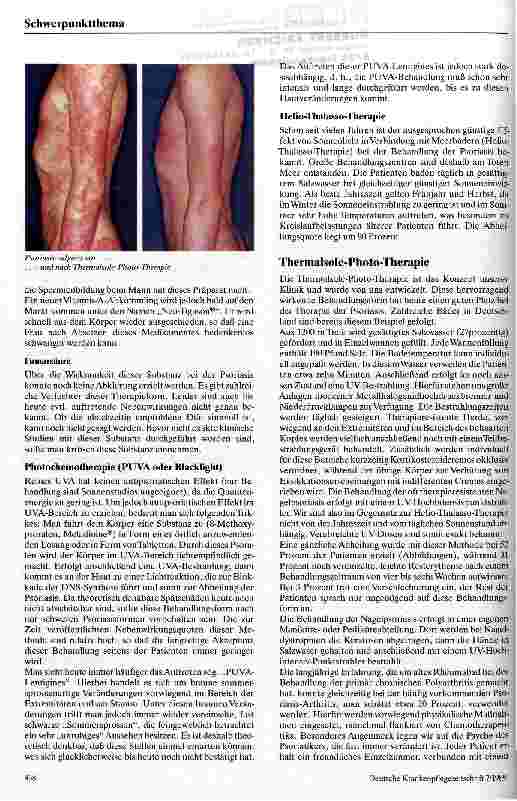 Vorschauseite 3: Der heutige Stand der Psoriasis-Behandlung