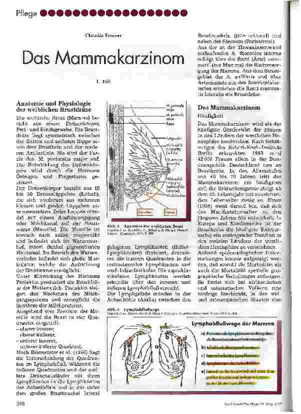 Vorschauseite 1: Das Mammakarzinom. Teil 1