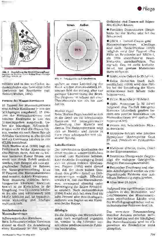 Vorschauseite 2: Das Mammakarzinom. Teil 1