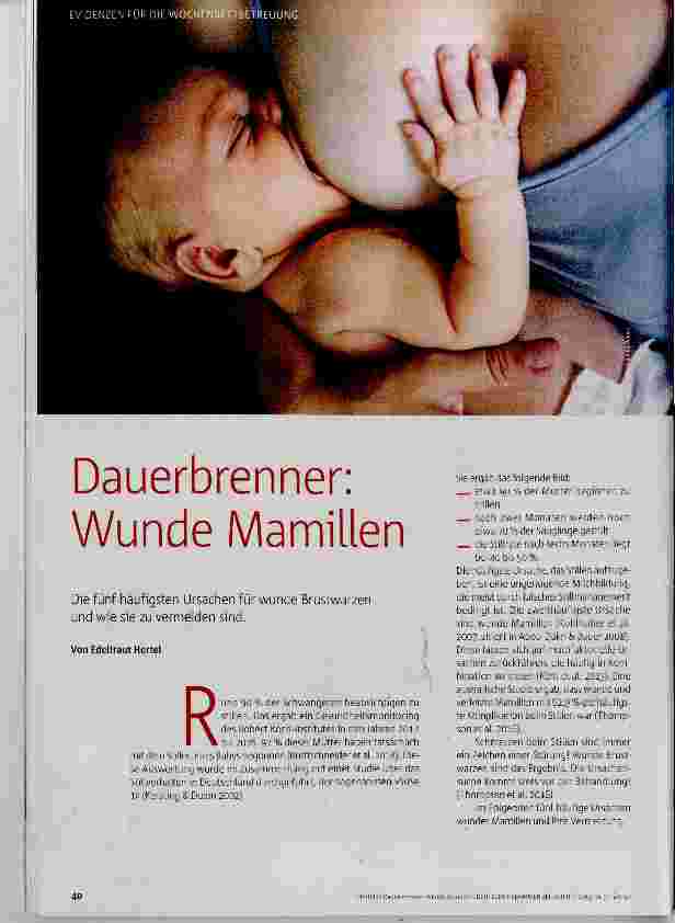 Vorschauseite 1: Dauerbrenner: Wunde Mamillen
