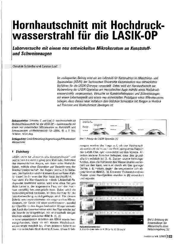 Vorschauseite 1: Hornhautschnitt mit Hochdruck Wasserstrahl für die LASIK-OPLaborversuche mit einem neu entwickelten Mikrokeratom an Kunststoffund Schweineaugen